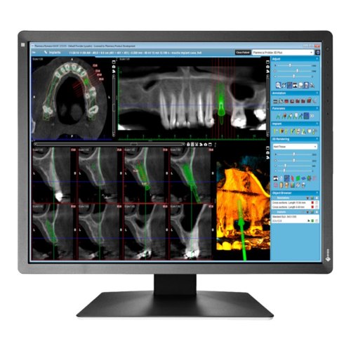 Монітор EIZO MX216-SB
