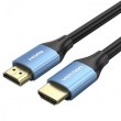 Кабель Vention HDMI, 10.0 м, V2.0, 4K 60Гц, Aluminum Alloy Blue