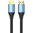 Кабель Vention HDMI, 10.0 м, V2.0, 4K 60Гц, Aluminum Alloy Blue