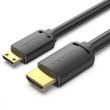 Кабель Vention HDMI, 1.5 м, V2.0 4K 60Гц 18Gbps HDR Dolby