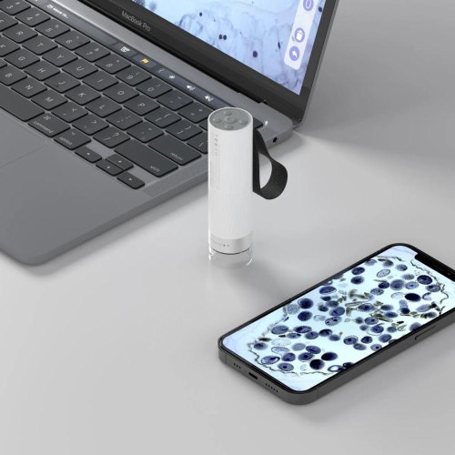 Розумний портативний мікроскоп Xiaomi BeaverLAB DDL-M1 Kit, платформа та аксесуари в комплекті (DDL-M1A)